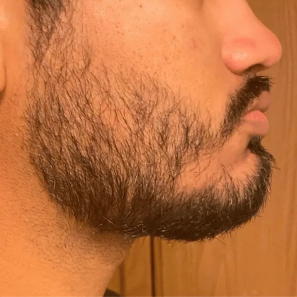 Before