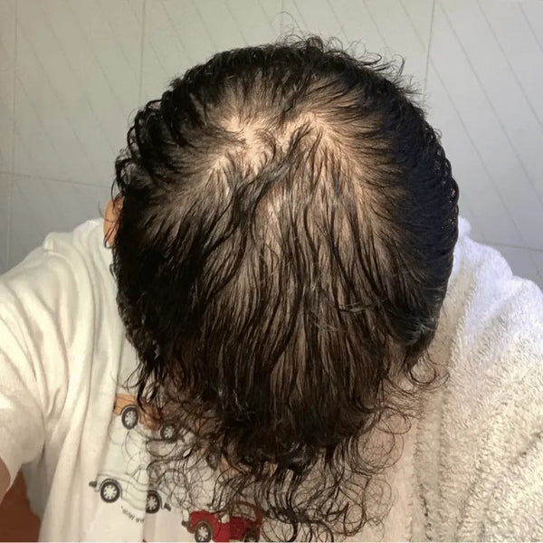 Before