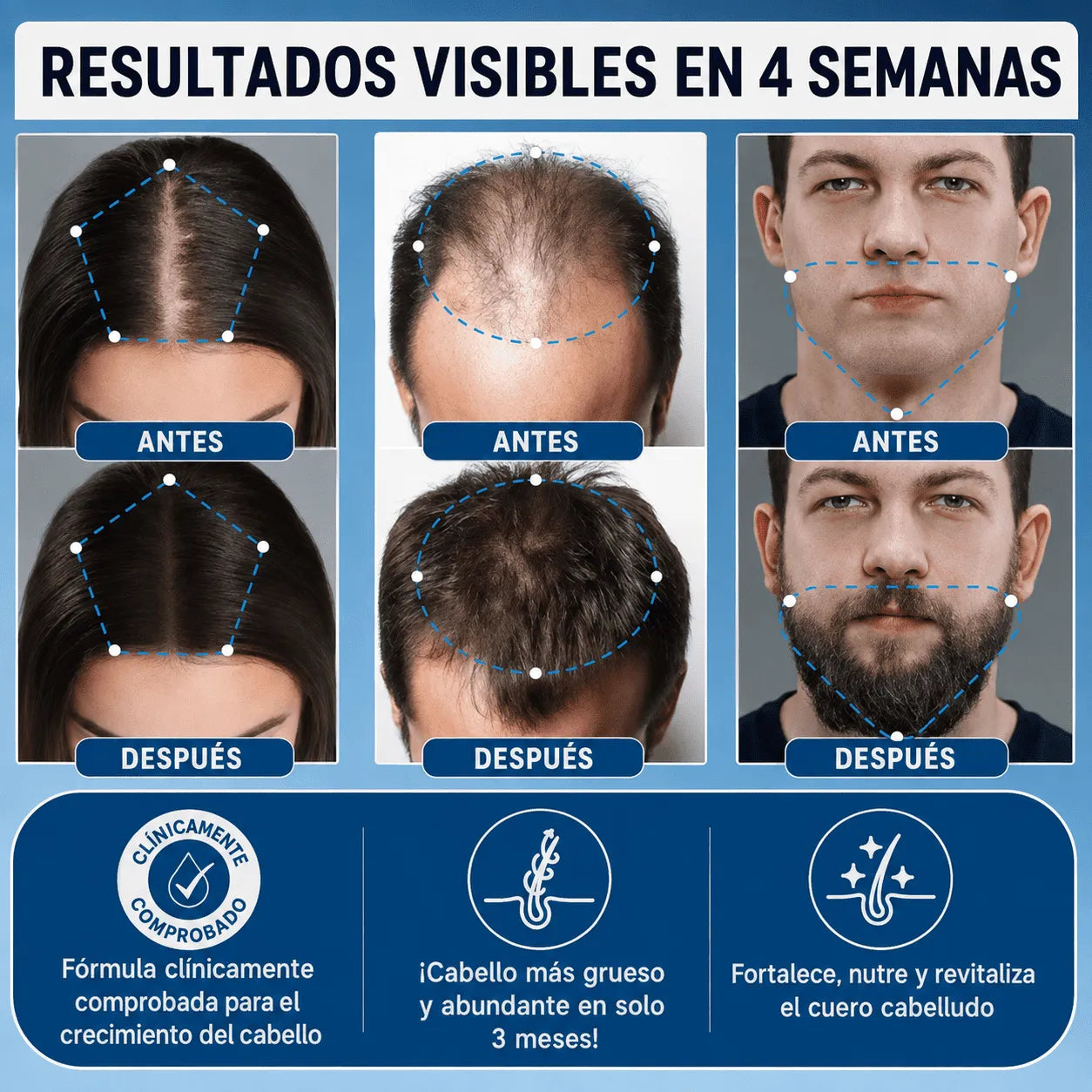 Sérum de Crecimiento Avanzado