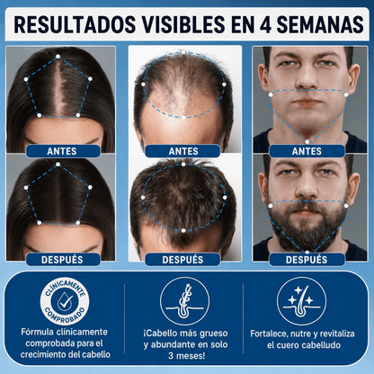 Sérum de Crecimiento Avanzado
